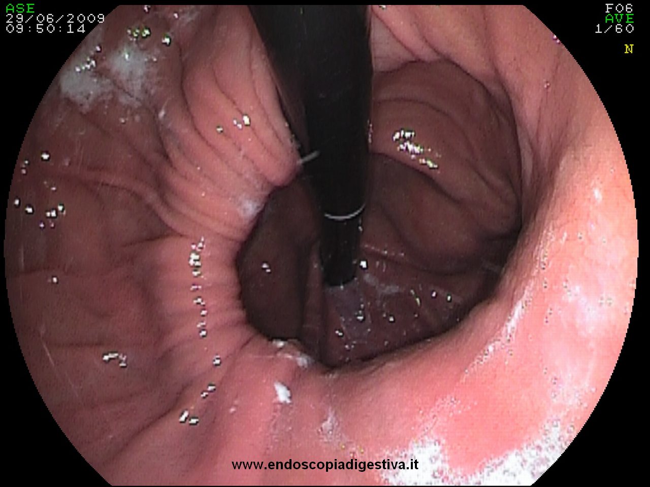 Clinica di chirurgia vascolare San Pietroburgo