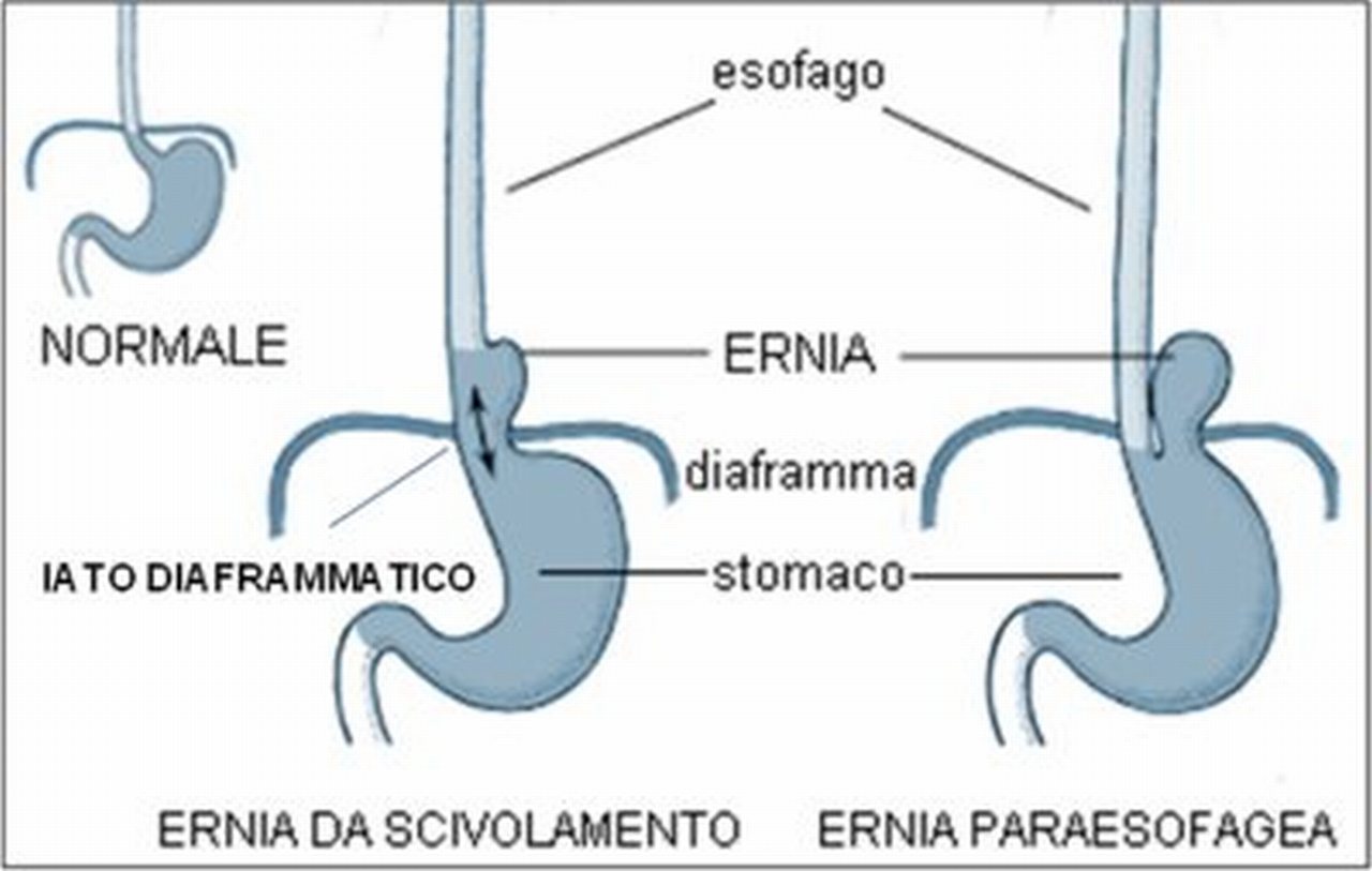 Varicosity su piedi di gambe