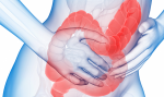 Colon irritabile ? Non sempre la diagnosi è corretta.
