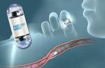Colonscopia con  video capsula